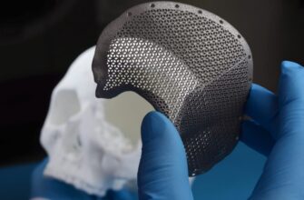 Що таке імпланти: все, що потрібно знати для вашого здоров’я