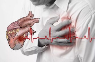 Інфаркт міокарда: розуміння причин, симптомів та методів лікування