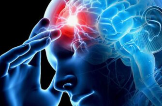 Інсульт: розпізнати симптоми та ефективні методи лікування