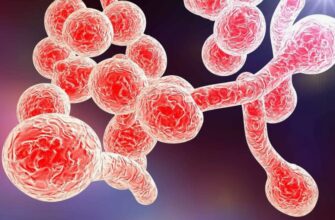 Кандидоз: Причини, симптоми та ефективні методи лікування