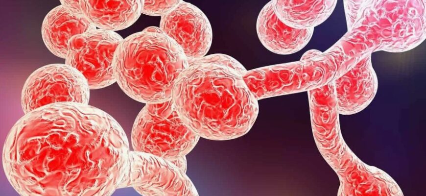 Кандидоз: Причини, симптоми та ефективні методи лікування