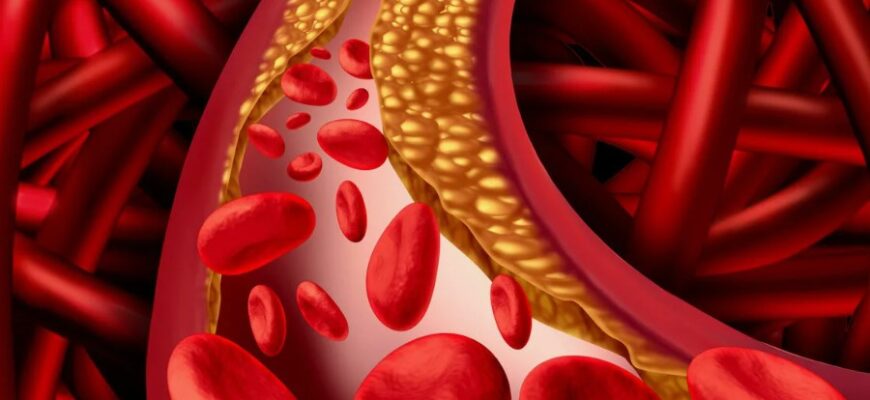 Що таке холестерин у крові: важливість, норми та як контролювати Що таке холестерин у крові: важливість, норми та як контролювати