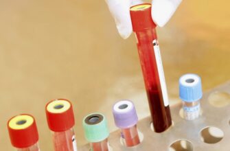 Що таке коагулограма крові: важливість та показники аналізу