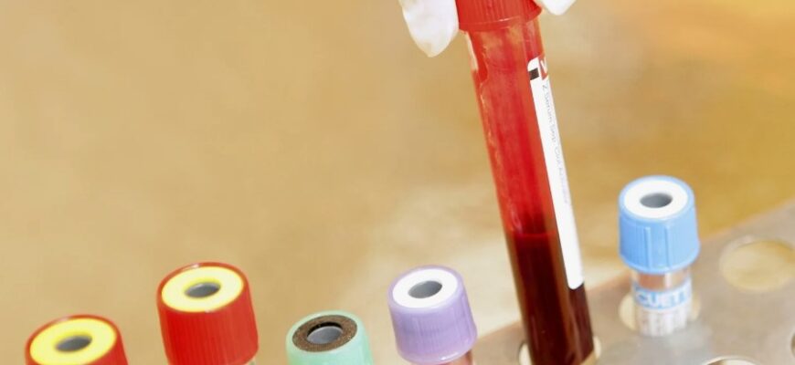 Що таке коагулограма крові: важливість та показники аналізу