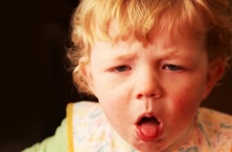 Коклюш: симптоми, причини та ефективні методи лікування хвороби