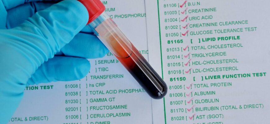 Ліпідограма крові: Що це, як проводиться та чому вона важлива для здоров’я