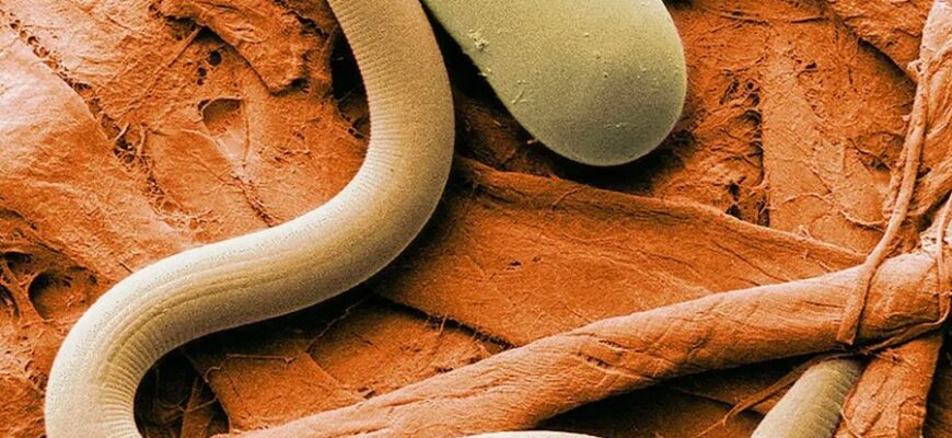 Нематоди: Визначення, особливості та їх роль у природній екосистемі