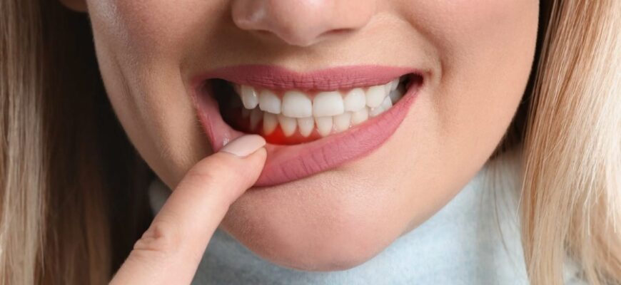 Що таке пародонтит: причини, симптоми та ефективні методи лікування