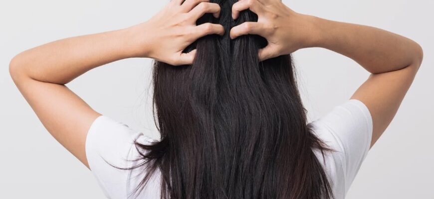 Що таке перхоть: причини, симптоми та способи боротьби з лупою