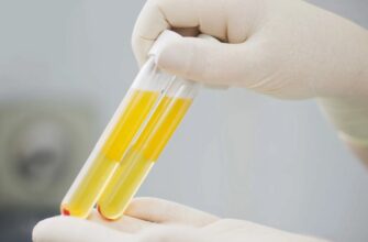 Що таке плазма крові: важливість, функції та відкриття для здоров’я