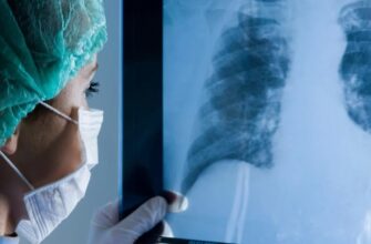 Що таке плеврит: причини, симптоми та методи лікування захворювання