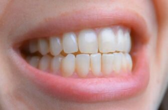 Що таке прикус: Важливі аспекти для здоров’я зубів та ротової порожнини