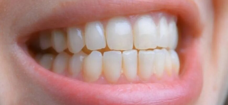 Що таке прикус: Важливі аспекти для здоров’я зубів та ротової порожнини