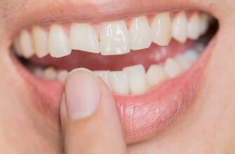 Реставрація зубів: повне керівництво методами та перевагами