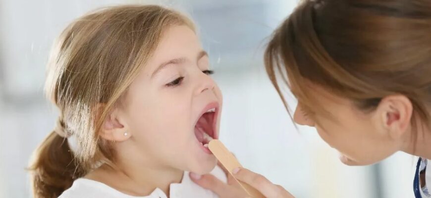 Скарлатина: причини, симптоми та ефективні методи лікування хвороби