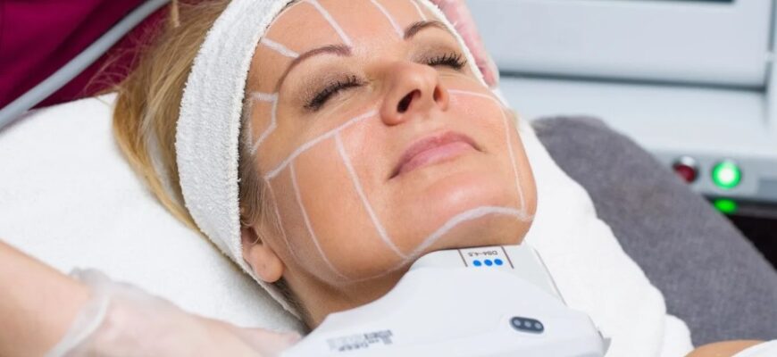 SMAS-ліфтинг: революційний метод омолодження шкіри обличчя