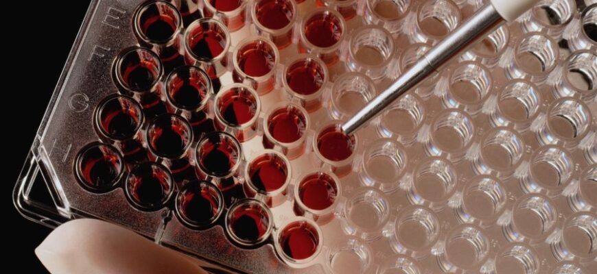 Тимолова проба: визначення, застосування та значення у медицині