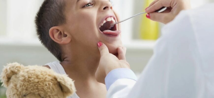 Що таке тонзиліт: причини, симптоми та ефективні методи лікування