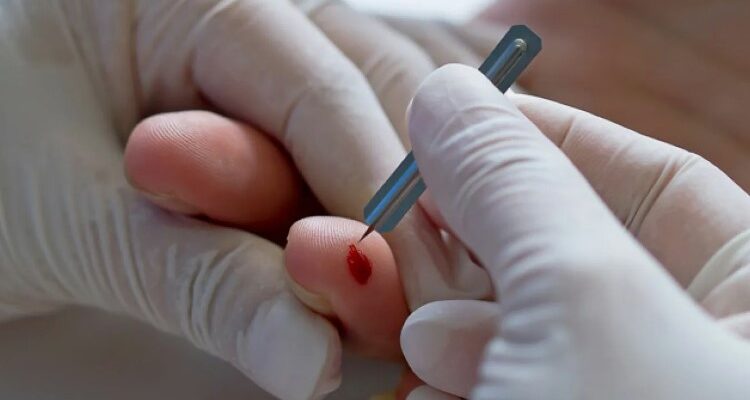 Що таке тромбоцити: роль у згортанні крові та здоров’ї організму