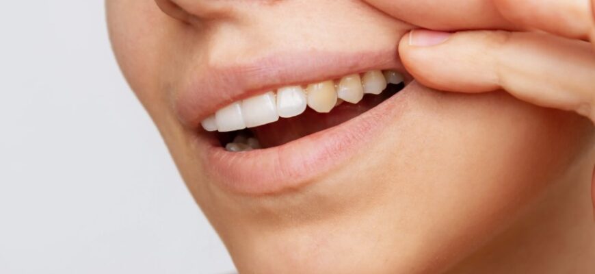 Зубна емаль: що це таке та як зберегти її здоров’я і міцність