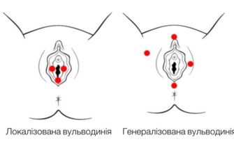 Все, що потрібно знати про вульводинію: симптоми, причини та лікування