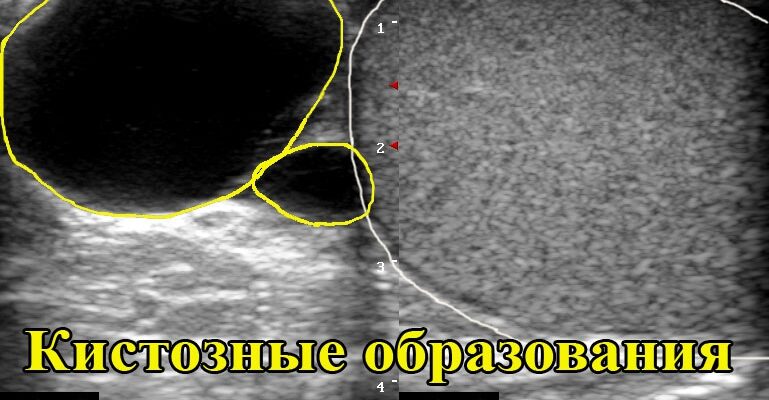 Ю чоловічих статевих органів: роль і функції органів калитки