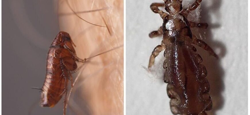 Воші та блохи: основні відмінності та як їх розпізнати