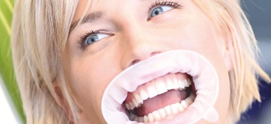 Оптрагейт: Що це таке та як впливає на продуктивність сайту?