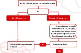 Невідкладна допомога при інфаркті міокарда: протокол дій та рекомендації