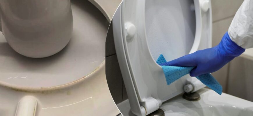 Ефективні методи для видалення сечового каменю з пластикових поверхонь