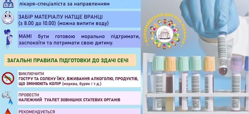 Чи можна їсти перед здачею сечі: вказівки для точності аналізів