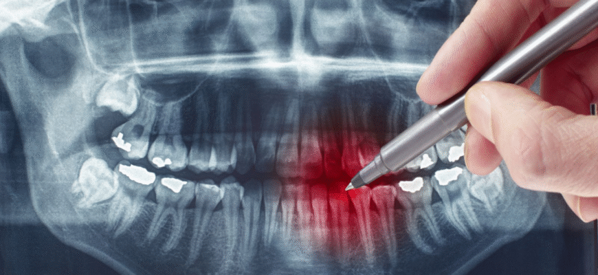 Чому стоматологи не радять вживати надто гарячу їжу: ризики для зубів