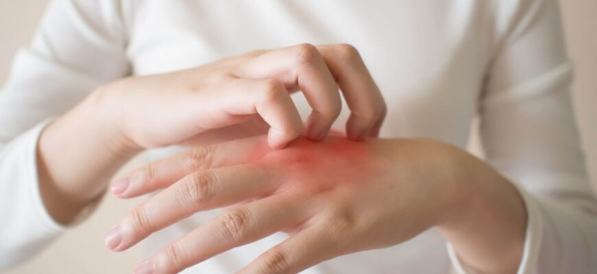 Червоні руки: причини, симптоми та методи вирішення проблеми