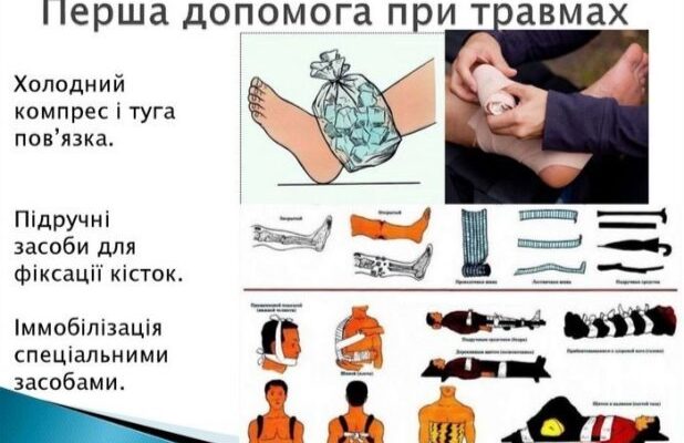 Перша допомога при травмах: ефективні поради та інструкції дій