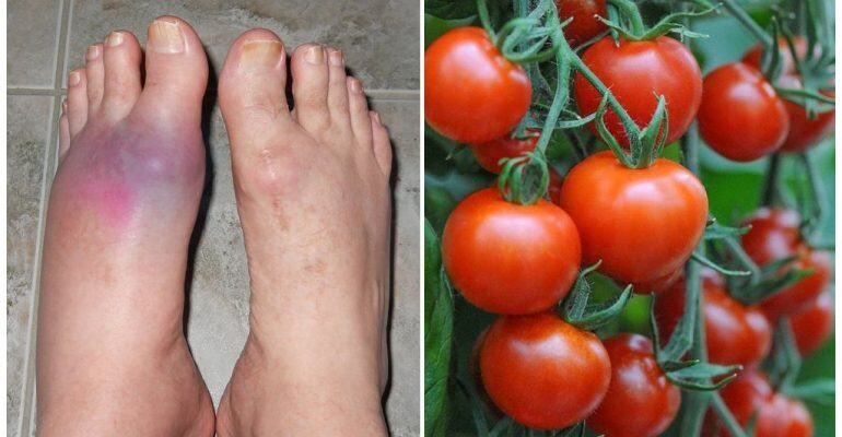 Чи можна їсти помідори при подагрі: корисні поради та застереження