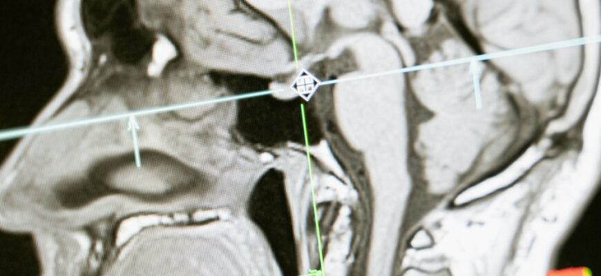 Точність міліметра: як КТ революціонізує лікування зубів у Корсуні