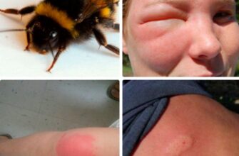 “Чим небезпечні джмелі для людини: ризики та як уникнути укусу”