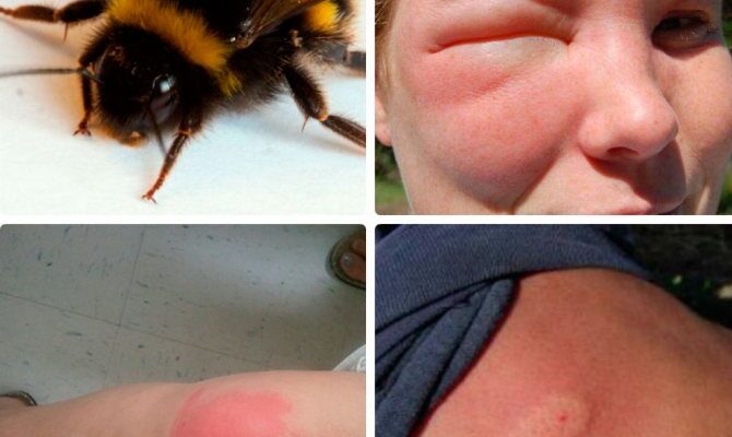 “Чим небезпечні джмелі для людини: ризики та як уникнути укусу”