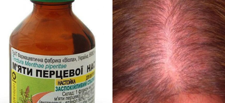 Ефективний рецепт: Як розвести настоянку м’яти для прискорення росту волосся Ефективний рецепт: Як розвести настоянку м’яти для прискорення росту волосся