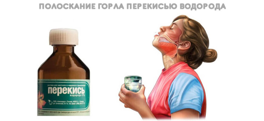 Як правильно розводити перекис водню з водою для полоскання рота
