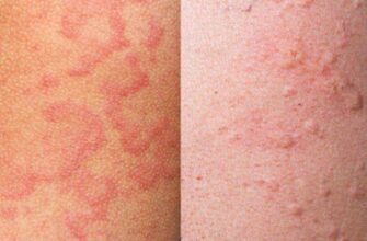 Ознаки Зовнішньої Будови Кропив’янки: Детальний Огляд та Особливості