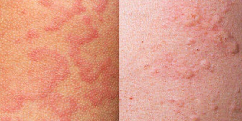 Ознаки Зовнішньої Будови Кропив’янки: Детальний Огляд та Особливості