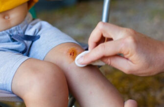 Як вчасно виявити ознаки правця: симптоми на ранніх стадіях