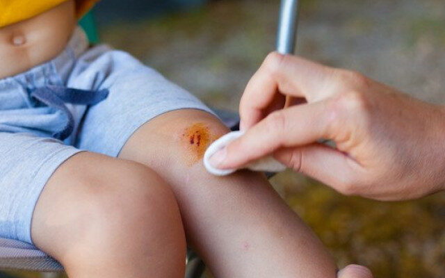 Як вчасно виявити ознаки правця: симптоми на ранніх стадіях