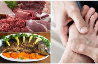 Яку рибу можна їсти при подагрі: поради і рекомендації лікарів