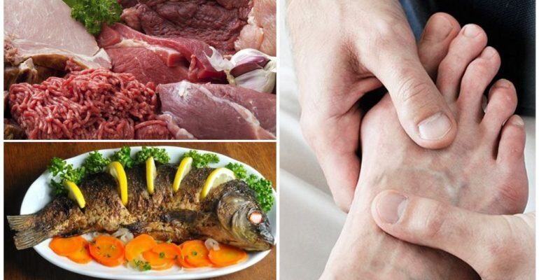 Яку рибу можна їсти при подагрі: поради і рекомендації лікарів