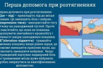 Перша медична допомога при вивихах: поради та рекомендації експертів