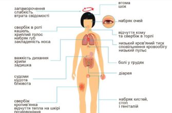 Як виникає алергія: причини, симптоми та способи запобігання