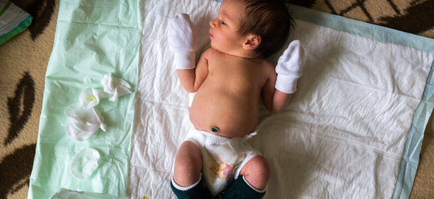 Визначення кольору шкіри новонароджених: норми та відхилення