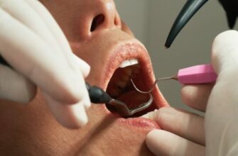 Що не можна їсти після гігієни зубів: уникніть цих продуктів!